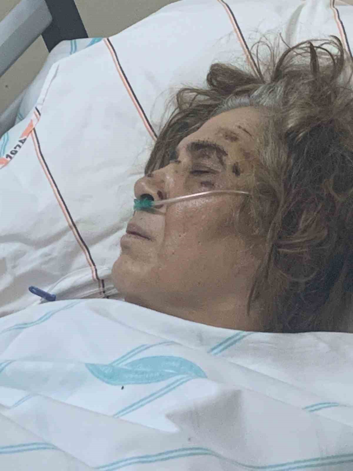 Sivas’ta Ehliyetsiz Sürücü Yaşlı Kadının Hayatını Kararttı Ama Göz Altına Bile Alınmadı